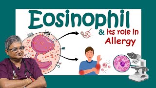 ইওসিনোফিল কি Why Eosinophils are SO Important for Your Body Role of eosinophils in allergy [upl. by Nawd611]