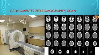 CT  computerized tomography Scan  in hindi [upl. by Jacobs468]