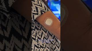 Testing the Medtronic Simplera CGM t1d diabetes [upl. by Kesley]