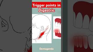 Non odontogenic pain  muscles of mastication  Digastric muscle [upl. by Ajtak747]