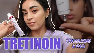 Tretinoin Troubleshooting FAQs for Common Concerns [upl. by Tcideneb479]