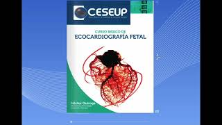 Manual de ecocardiografía fetal Pronto a la venta [upl. by Comethuauc]