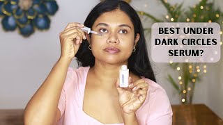 7 Days Dark Circles Removal Challenge  Sushmitas Diaries [upl. by Drice]