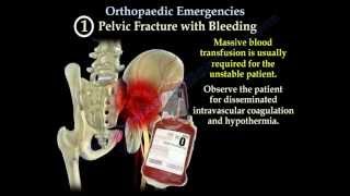 Orthopaedic Emergencies Part 1  Everything You Need To Know  Dr Nabil Ebraheim [upl. by Ermentrude]