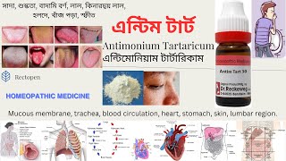 08 Antimonium Tartaricum l এন্টিম টার্ট l মেটেরিয়া মেডিকা l Materia Medical Learn Antim Tart easily [upl. by Akirdnwahs549]