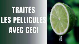 ASTUCE TRÈS EFFICACE POUR TRAITER LES PELLICULES ET LES DEMANGEAISONS DU CUIR CHEVELU cuirchevelu [upl. by Aymer]