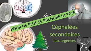 SEMIOLOGIE ALGIES CRANIOFACIALES céphalées [upl. by Karli]