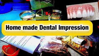 How to take Alginate Impressions [upl. by Hut963]