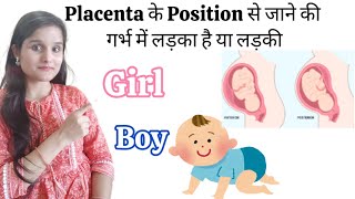 Placenta से पता करे की गर्भ में लड़का है या लड़की  Placenta Position in Pregnancy [upl. by Hahnert593]