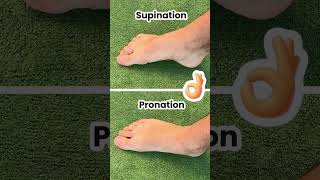 Fix Your Bunions amp Overpronation at The Same Time [upl. by Feola]