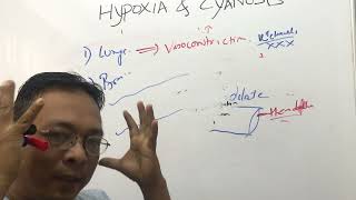 Hypoxia and Cyanosispathophysiology [upl. by Alyakam]