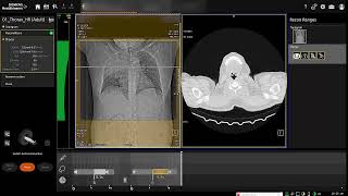 HRCT Chest with filming [upl. by Emirak]