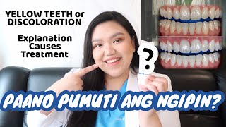 HOW TO WHITEN YOUR TEETH in an AFFORDABLE WAY 🦷✨  Dr Bianca Beley [upl. by Iadam]