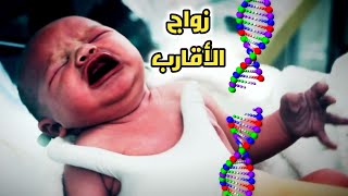 هل زواج الأقارب ممكن ينتج عنه أطفال مشوهة؟ Consanguineous marriage and genetic diseases [upl. by Sanbo]