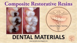 Composite Restorative Resins  Dental Materials [upl. by Lalo]