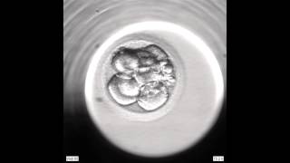 Development of an Embryo from 2PN to Blastocyst via an EmbryoScope [upl. by Ulyram256]