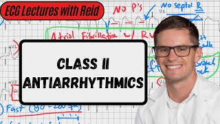 Class II Antiarrhythmic Agents  ECG Lecture [upl. by Kcirdez128]