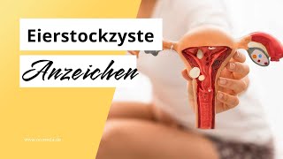 Eierstockzyste Symptome und Anzeichen [upl. by Carberry]