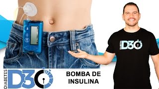 Bomba de insulina como funciona  Diabetes D30 [upl. by Dyson]