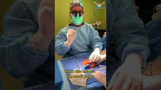 Live surgery snippet Malunion of index finger [upl. by Bahner]