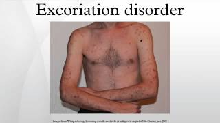 Excoriation disorder [upl. by Gayla]