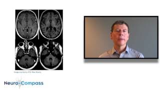 Risks of gadolinium accumulation in MRI [upl. by Hepsibah703]