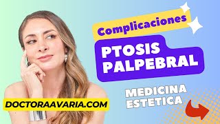 Complicaciones por Toxina Botulínica Ptosis Palpebral o Caída del Párpado [upl. by Ssew]