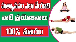 Matsyasana  Fish Pose  Steps  Benefits  Yogic Fitness  Telugu Vaakitlo [upl. by Modeste]