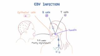 EBV and Mononucleosis  Pathogenesis and Clinical Presentation [upl. by Nebur]