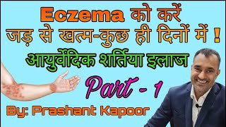 Permanent treatment for Eczema Ayurvedic remedy  Prashant Kapoor [upl. by Rochella]