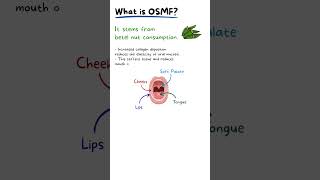 Oral Submucosis Fibrosis Explained [upl. by Gerbold646]