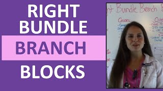 How to Interpret EKG Right Bundle Branch Blocks on ECG for Nurses [upl. by Nertie975]