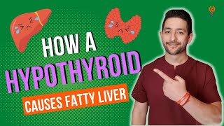 How a Hypothyroid Causes Fatty Liver NAFLD [upl. by Mellman432]