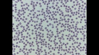 Plasmodium falciparum [upl. by Notyarb212]