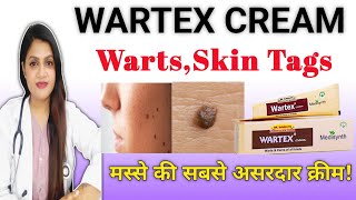 मस्से हटाने की सबसे असरदार क्रीम wartex homeopathic medicine uses in hindi [upl. by Nuavahs857]