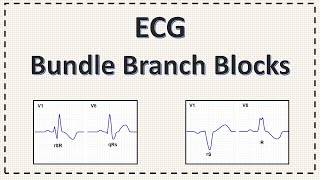 Bundle Branch Block  ECG  Right Bundle Branch Block  Left Bundle Branch Block  Explained [upl. by Llertnov]