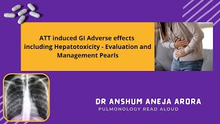 Anti  TB drugs side effects and Hepatotoxicity Management Pearls [upl. by Vitoria]