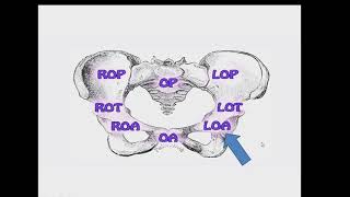 Mechanism of labour left occipitoanterior position in nepali lectureनेपाली nursing lecture [upl. by Nawor]