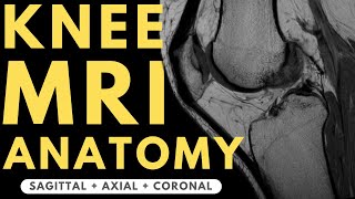 Knee MRI Anatomy  Radiology anatomy part 1 prep  How to interpret a knee MRI [upl. by Barnum]