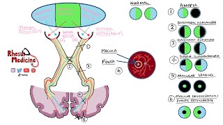 Visual Pathway Physiology and Lesions  Visual Field Defects  Special Senses Physiology [upl. by Cardew567]