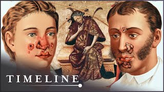 1495 Syphilis Outbreak The Deadly Disease That Swept Across Europe  The Syphilis Enigma  Timeline [upl. by Franck]