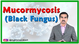 Mucormycosis  Black fungus disease in Covid 19 Causes Signs amp Symptoms Diagnosis and Treatment [upl. by Phillada78]