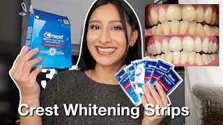 I TRIED THE CREST 3D WHITESTRIPS FOR 14 DAYS Effective  Before amp After pictures [upl. by Timmie]