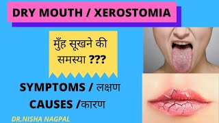 WHAT IS DRY MOUTH XEROSTOMIA  CAUSES AND SYMPTOMS HINDI [upl. by Esilram]