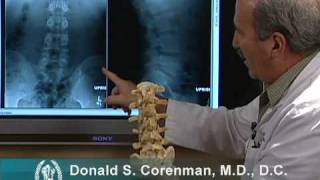 How to Read Xrays of the Lumbar Spine Lower Back  Spine Surgeon Colorado [upl. by Gardell]