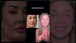 ANTES E DEPOIS DE SCHEILA CARVALHO [upl. by Dranel]