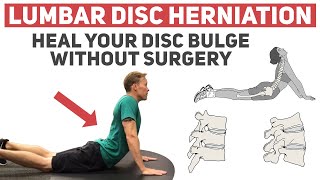 How to Heal Your Disc Herniation Without Surgery [upl. by Eiralam16]