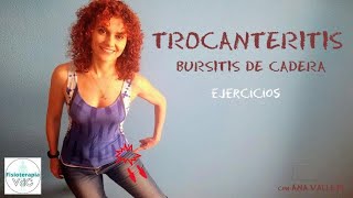 Trocanteritis o bursitis de cadera Ejercicios y tratamiento para disminuir el dolor [upl. by Nilram125]