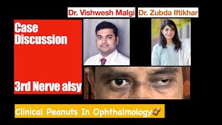 case Discussion  Oculomotor Third Nerve Palsy [upl. by Marve685]