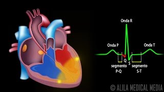 El Sistema de Conducción Cardíaca y la Relación con ECG Animación Alila Medical Media Español [upl. by Alarice]